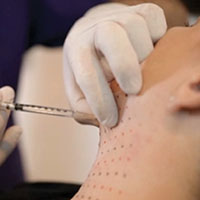 ATX-101 получил одобрение FDA ATX-101 получил одобрение FDA