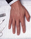 Протокол процедуры по уходу за кожей рук для мужчин