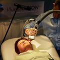 Процедура Finepeel Процедура Finepeel