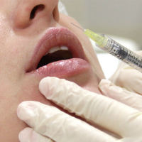 Restylane и Juvederm – самые популярные в России филлеры Restylane и Juvederm – самые популярные в России филлеры