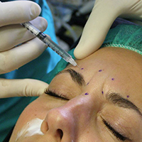 Xeomin и Botox демонстрируют равную эффективность Xeomin и Botox демонстрируют равную эффективность