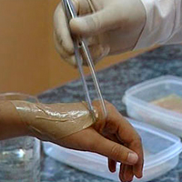 Биокожа G-DERM признана учеными Биокожа G-DERM признана учеными