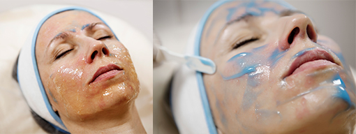 Easy Droxy Peel Easy Droxy Peel