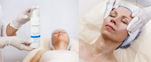 Easy Droxy Peel Easy Droxy Peel