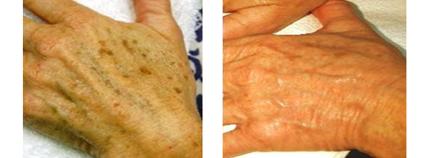 finepeel_heands.jpg finepeel_heands.jpg
