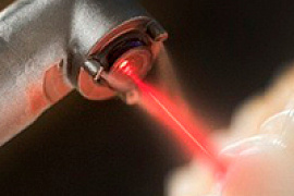 Восстановление зубов с помощью лазера