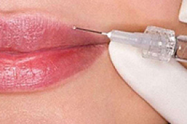 Увеличение объема губ канюлей или иглой. Есть ли разница для пациента?