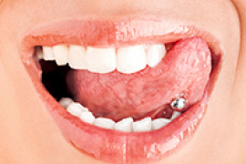 Пирсинг языка разрушает зубы