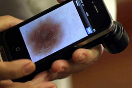 Новое мобильное приложение для диагностики заболеваний кожи
