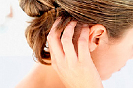Псориаз волосистой части головы
