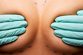 Операция по уменьшению и подтяжке груди