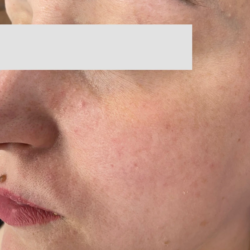 Водородный гидропилинг Hydra Touch H2