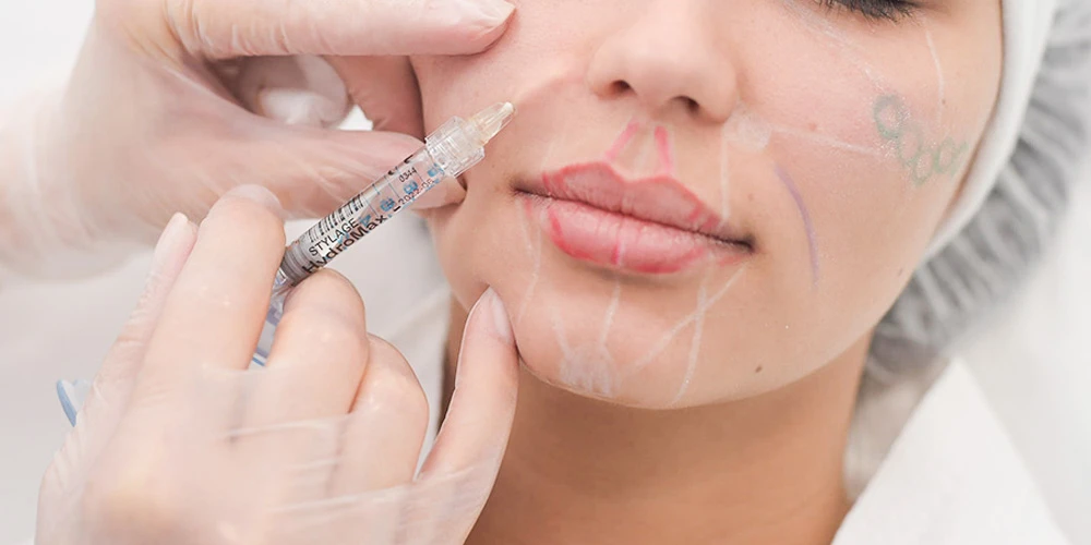 Схема введения Stylage HydroMax