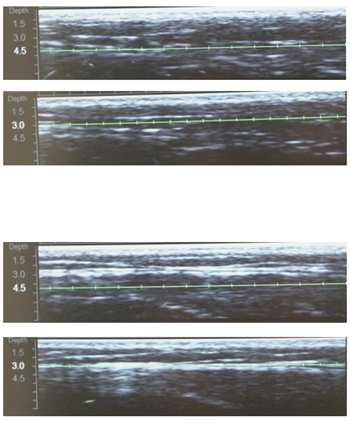 Протокол Альтера-терапия