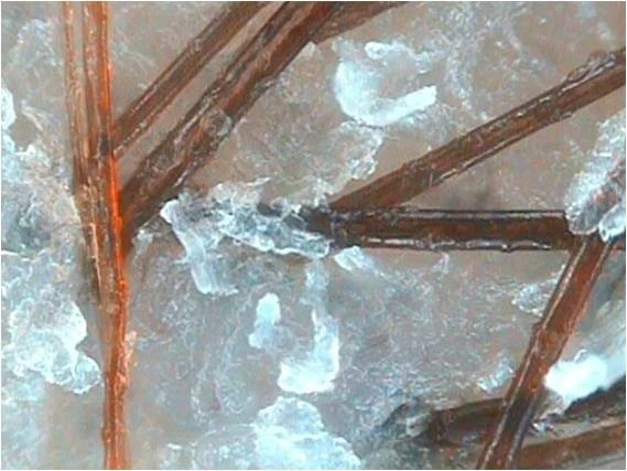 Себорейный дерматит