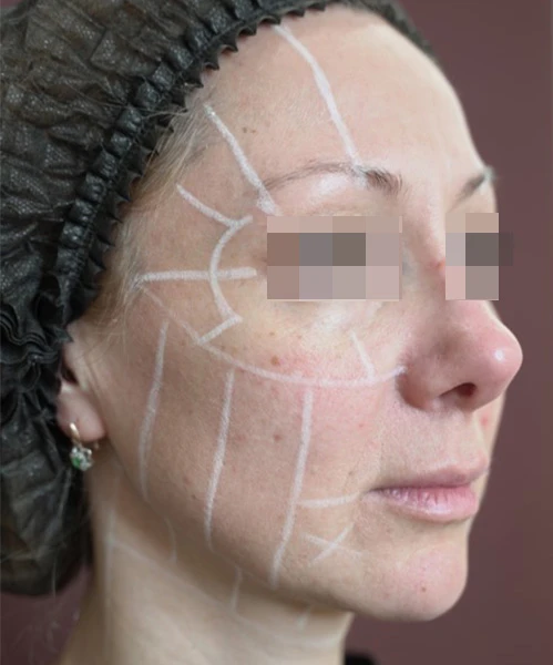 Диагностическая визуализация щёчной, периоральной и периорбитальной зон