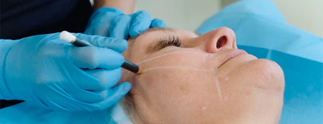 Осложнения после нитей