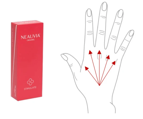 Neauvia Stimulate