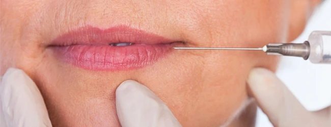 контурная пластика губ филлер