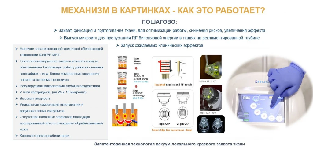 аппарат INUS