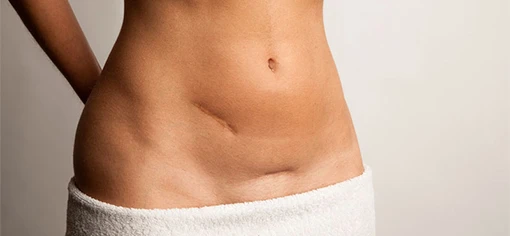 Устранение рубцов