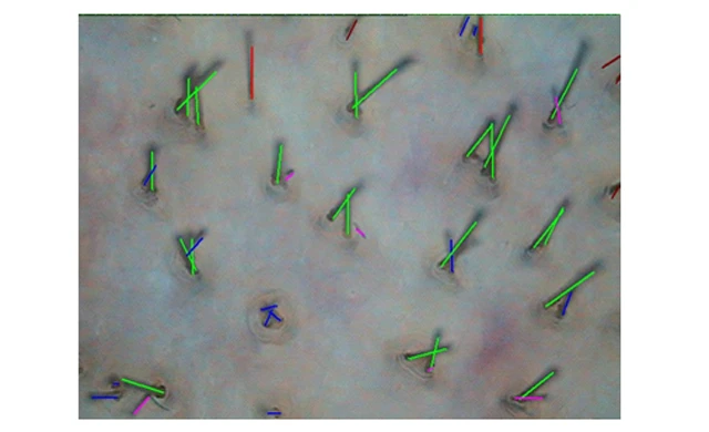 Затылочная зона