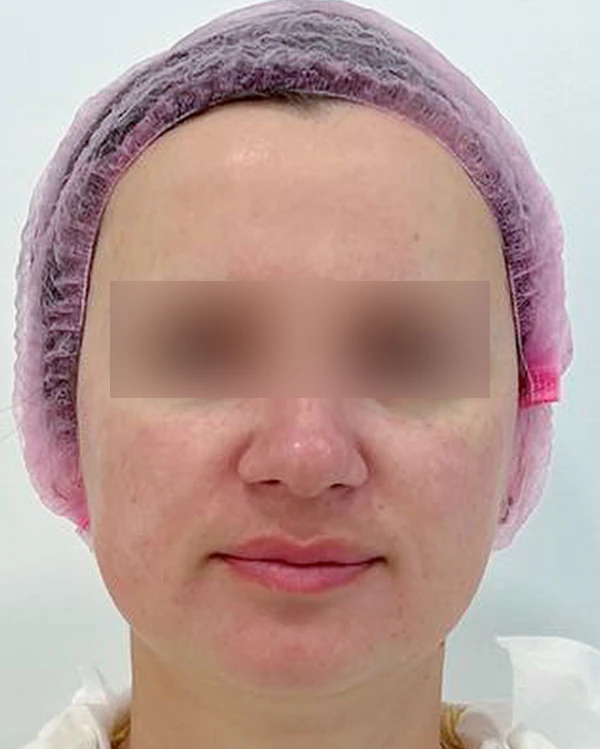 Skin Longevity