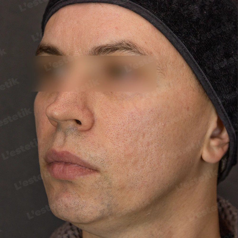 До