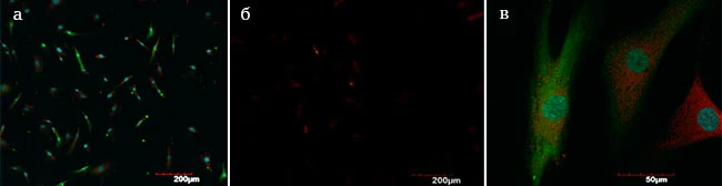 Экспрессия цитокератина-19 и эластина в фибробластах
