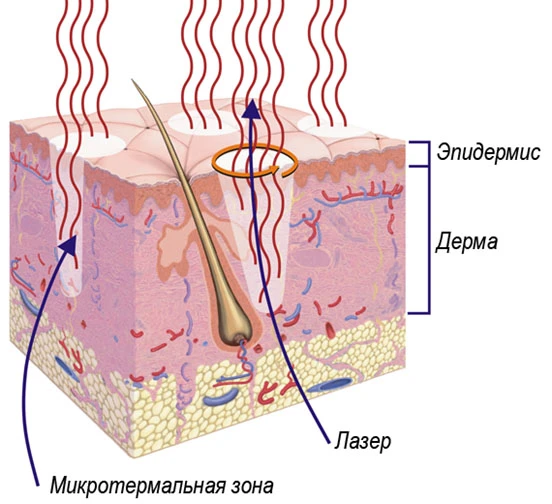 ЗМН.jpg
