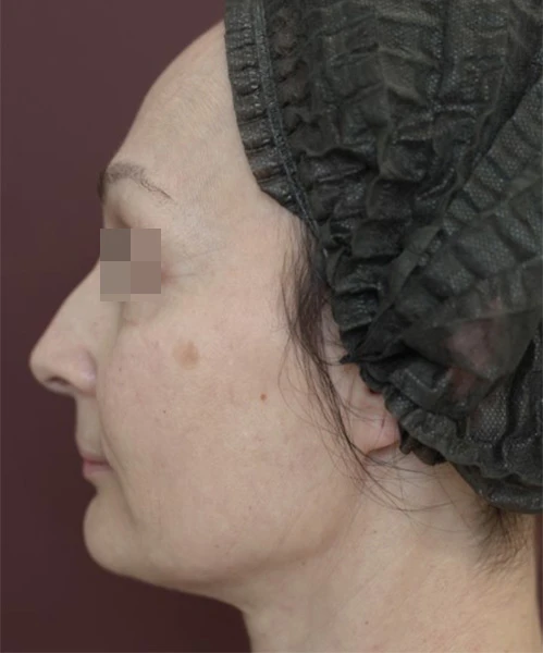 Клинический результат