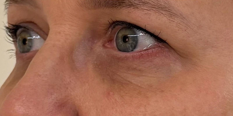 фракционный термолиз на аппарате CAPELLO CO2 Re:Flex, фото после