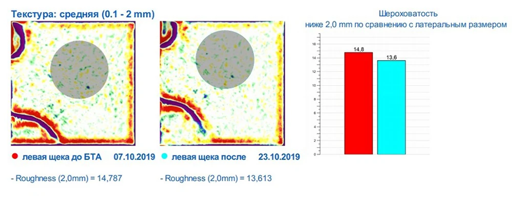 Ксеомин, исследование
