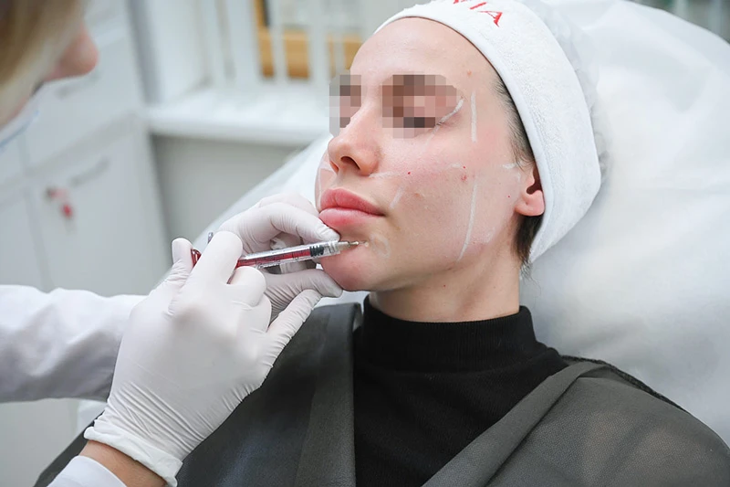 Введение препарата Neauvia Intense Flux