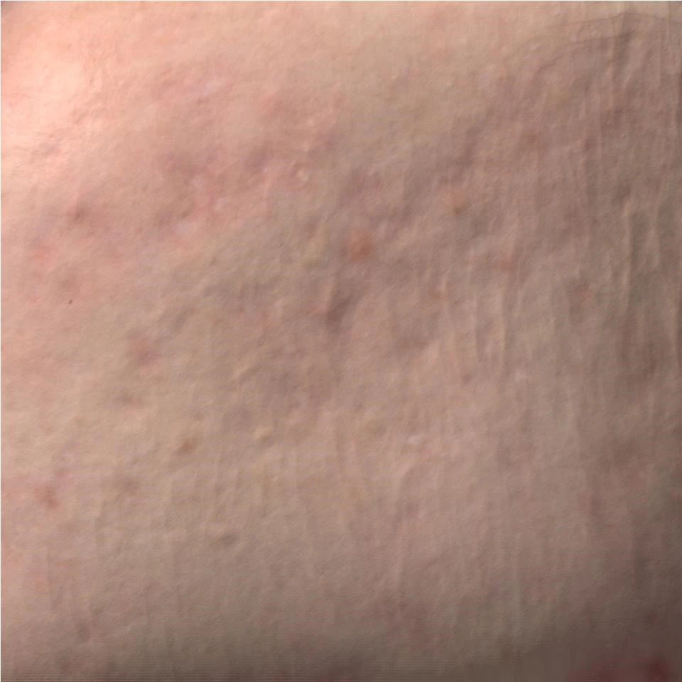 до и после проведенного курса Геля PRX-T33