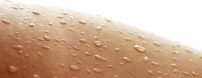 Гипергидроз: потоотделение