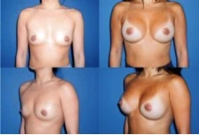 Пример груди 2 класса