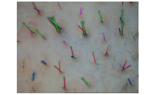 Теменная зона