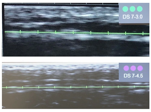 Диагностическая визуализация