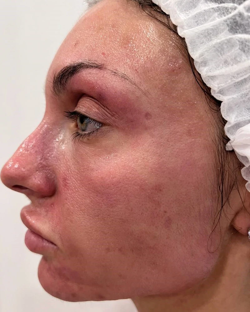 Calecim Professional Serum