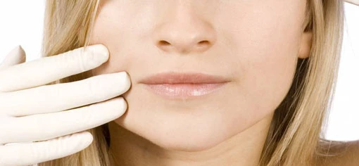  Нитевые подтяжки