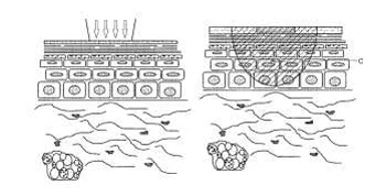 лечение светом