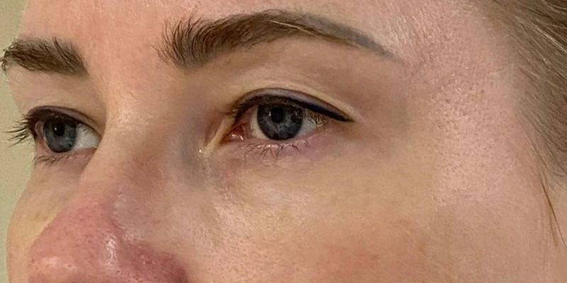 фракционный термолиз на аппарате CAPELLO CO2 Re:Flex, фото до