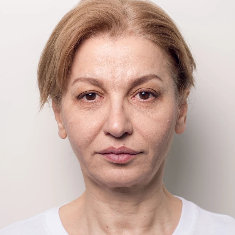 Алла, 32 года. Фото после
