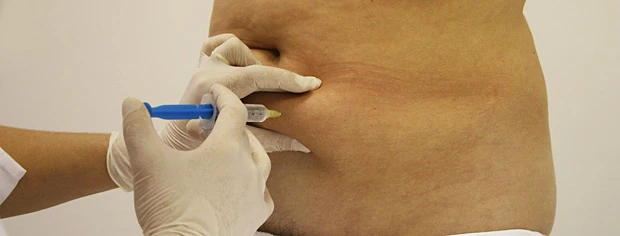 Протокол мезокоррекции локальных жировых отложений