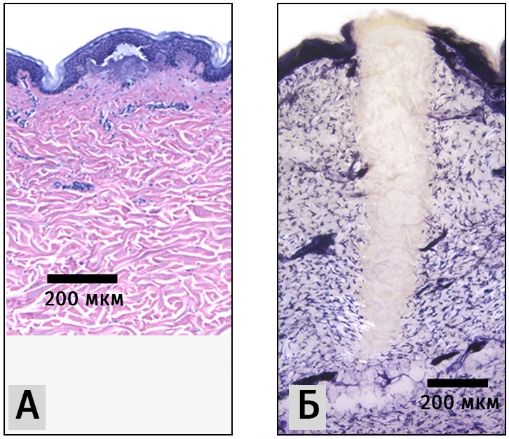 Гистология