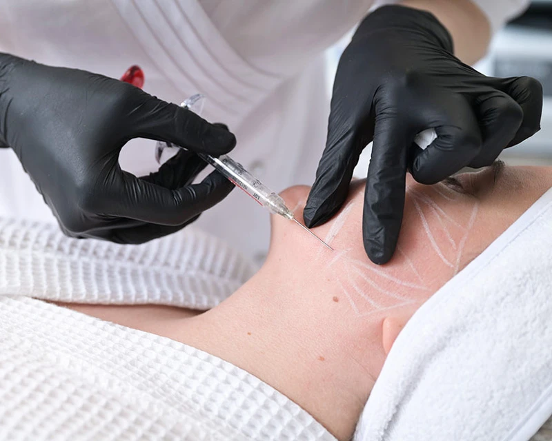 Neauvia Введение