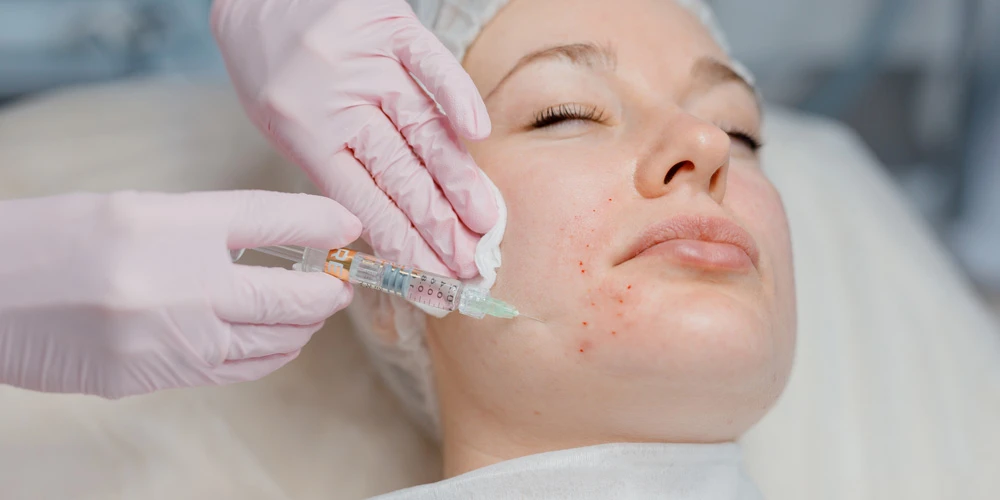 биоревитализанты REVI