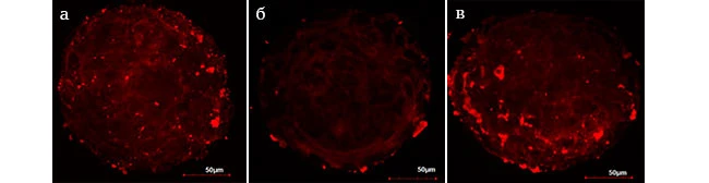 Экспрессия эластина