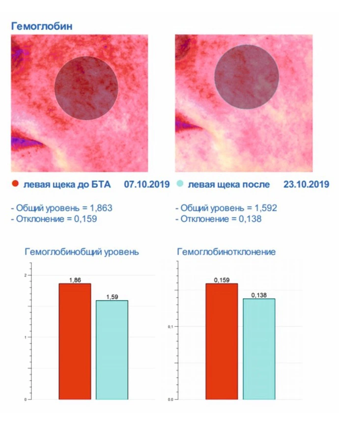 Ксеомин, исследование